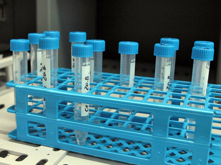 Abbildung: Das Foto zeigt in einem Labor einen blauen Kunststoff-Ständer, der zwölf Probenröhrchen mit blauen Deckeln enthält.