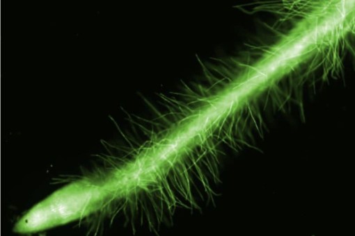 Picture: The macroscopic photo shows the hairs of a root in bright green color against a black background