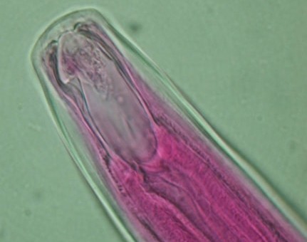 Abbildung: Das Foto zeigt die mikroskopische Aufnahme eines Nematoden der Gattung Momonchus.