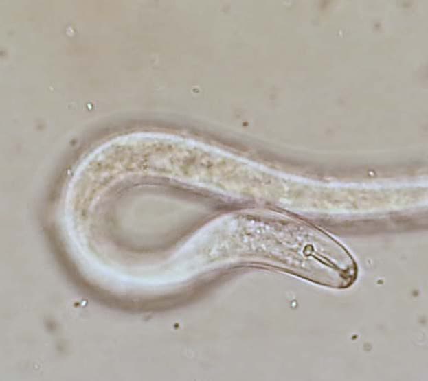 Picture: The photo shows the microscope image of a nematode specimen of the species Pratylenchus.
