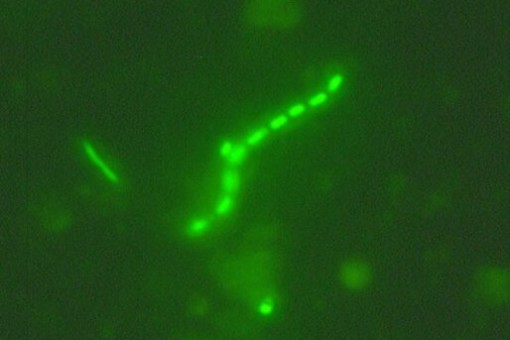 Abbildung: Das Foto zeigt die mikroskopische Aufnahme von leuchtend grün dargestellten Bakterien-Zellen bei einer Zählung.