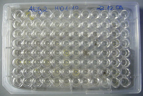Picture: The photo shows a top view of a transparent microtiter plate with processed sample material from the Exploratory Schwäbische Alb.